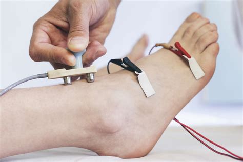 painful nerve conduction study